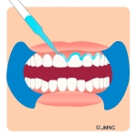 _userdata/officewhitening_a03.jpg