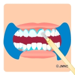 _userdata/officewhitening_a04.jpg